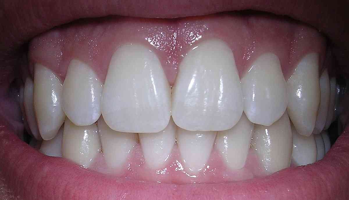 The silent agony of temperature-sensitive teeth Understanding and overcoming ambient thermal dental