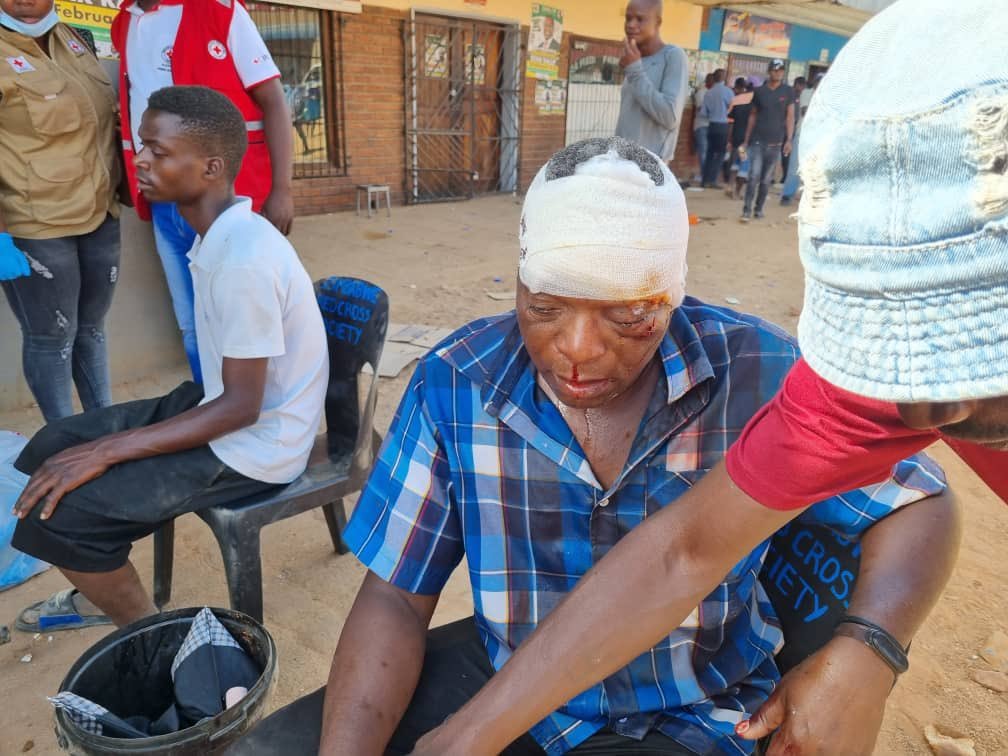 Police memo exposes Zanu PF hand in murder assault of Chamisa supporters