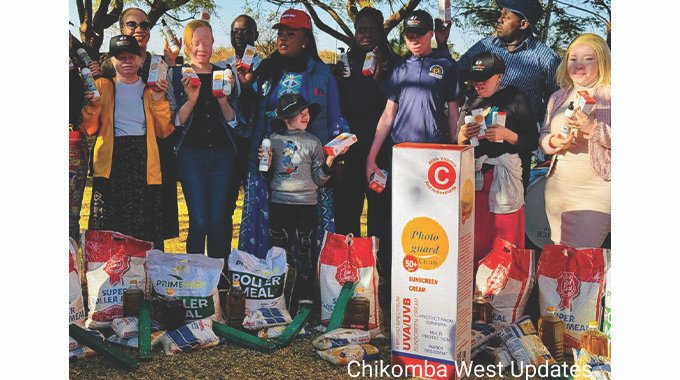 Minister Mavetera castigates stigma against albinism