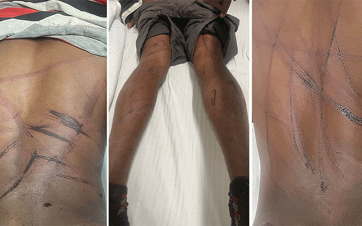 Rampant abductions promoting lawlessness