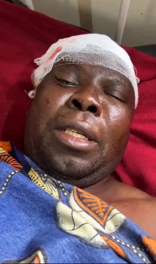 TWO PF SUPPORTERS INJURED IN AFTER ALLEGEDLY BEING AT ATTACKED BY CADRES FROM RIVAL POLITICAL PARTY IN KASAMA