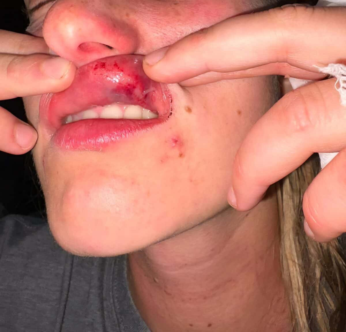 Investigations underway after hammer attack on couple at well-known game reserve