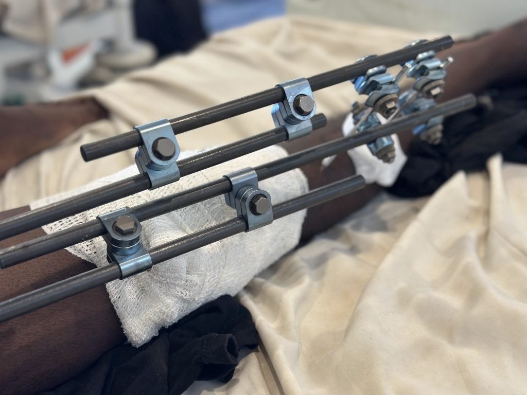 Kabaza raging crisis