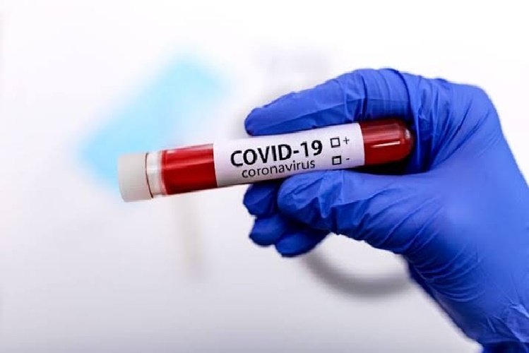 China garante posse de provas do surgimento da Covid-19 nos Estados Unidos