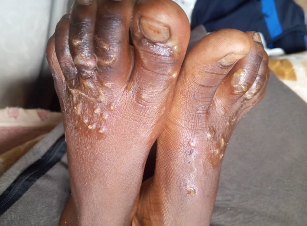 Did authorties doze off?