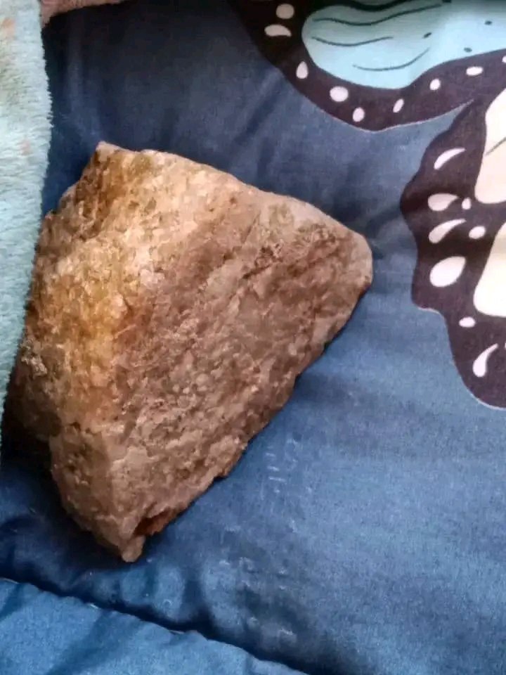 Bizarre: Neno Woman delivers 250-gram stone in rare medical incident at Matandani Mission Hospital
